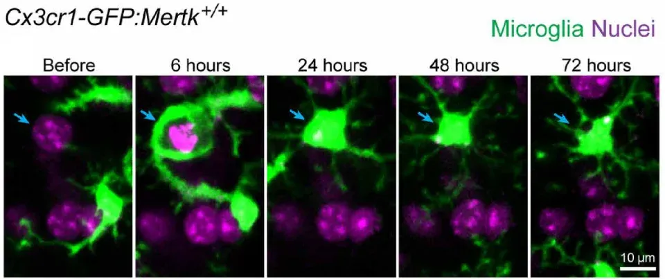 Imagerie en accéléré de la phagocytose microgliale d'un neurone mourant