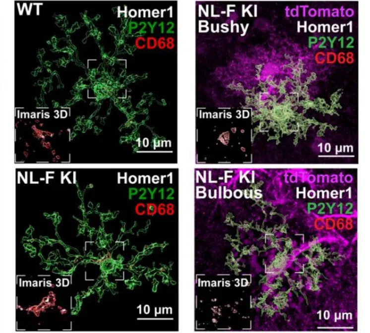 Enveloppement des synapses par les microglies à proximité des astrocytes bulbeux