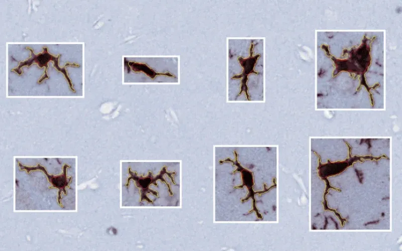 Microglia Morphology