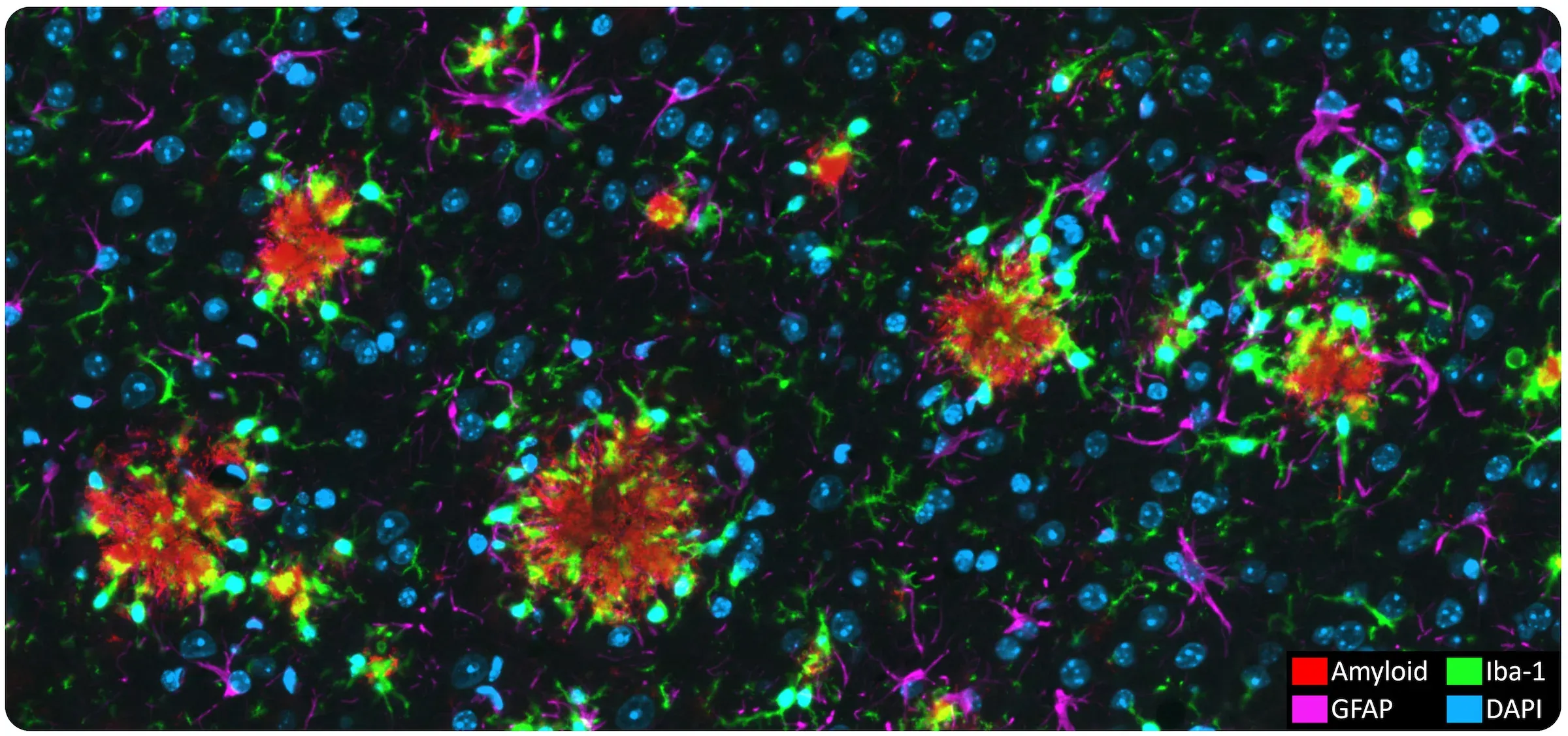 Multiplexed IHC image