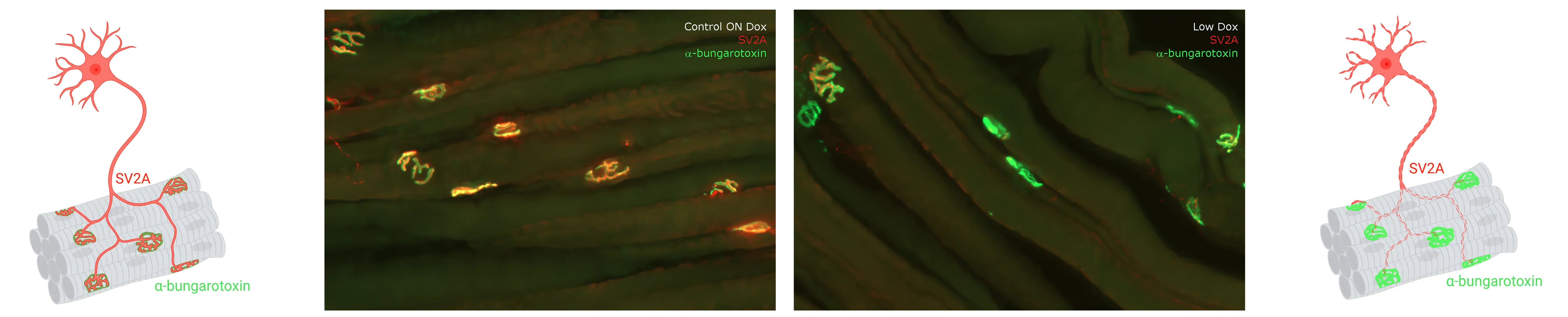 mIF images of NMJs from control and Low Dox rNLS8 mice
