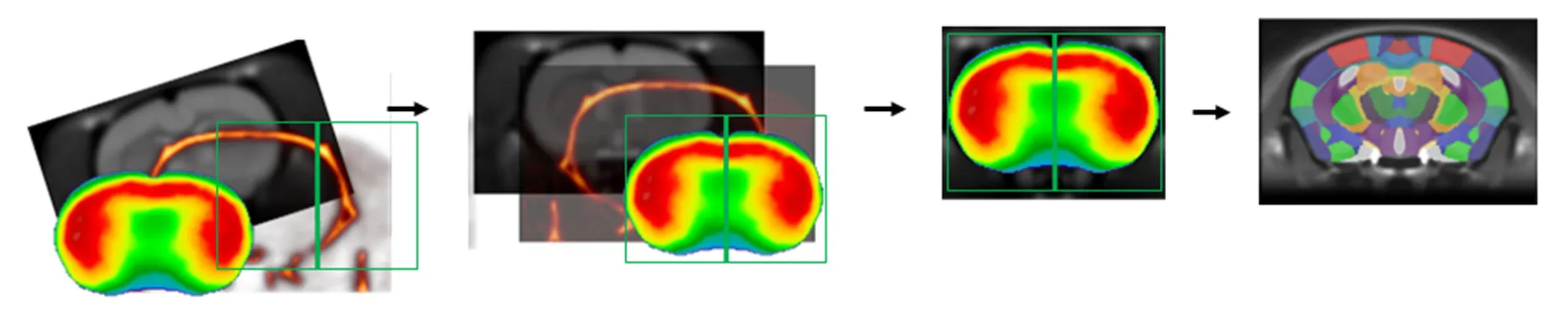 In Vivo Imaging - PET Processing Pipeline 