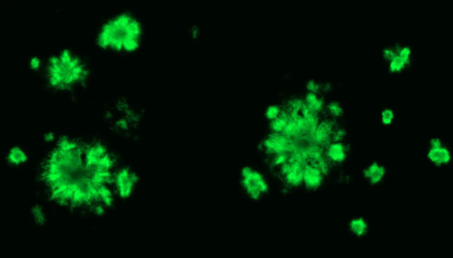 Image des plaques amyloïdes PFTAA