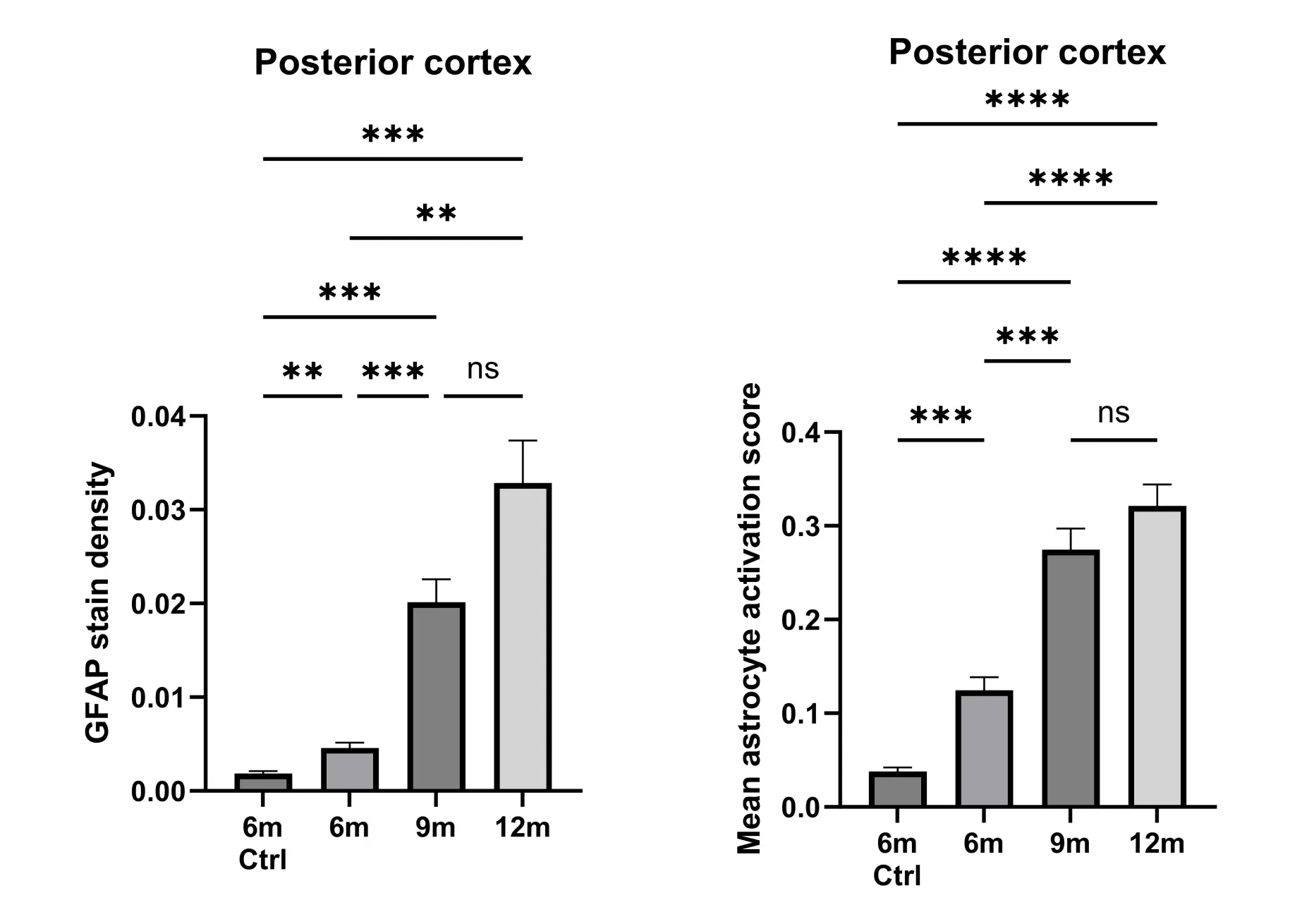 Quantifying the morphology of astrocytes