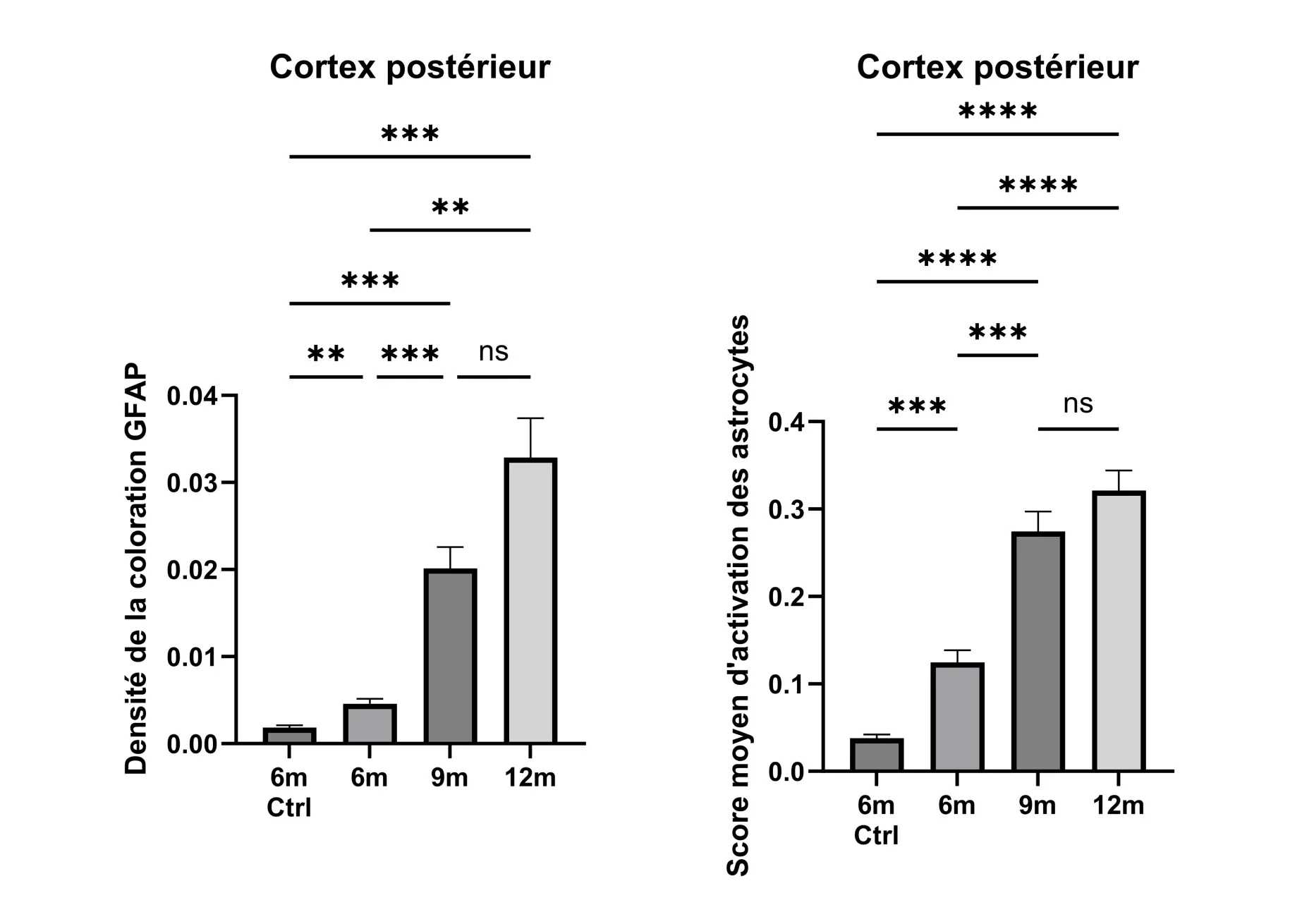 Quantifier la morphologie des astrocytes