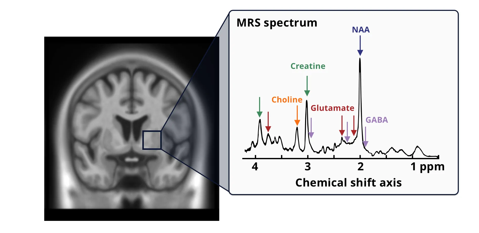 Metabolite signals acquired using an 1H-MRS spectrum