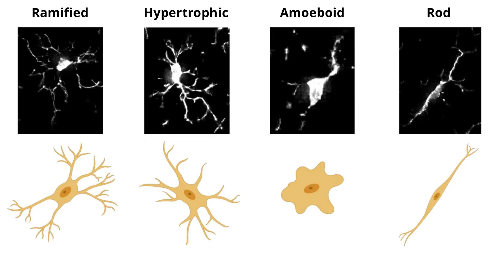 Microscopy images and schematic representations of four selected morphologies of microglia.