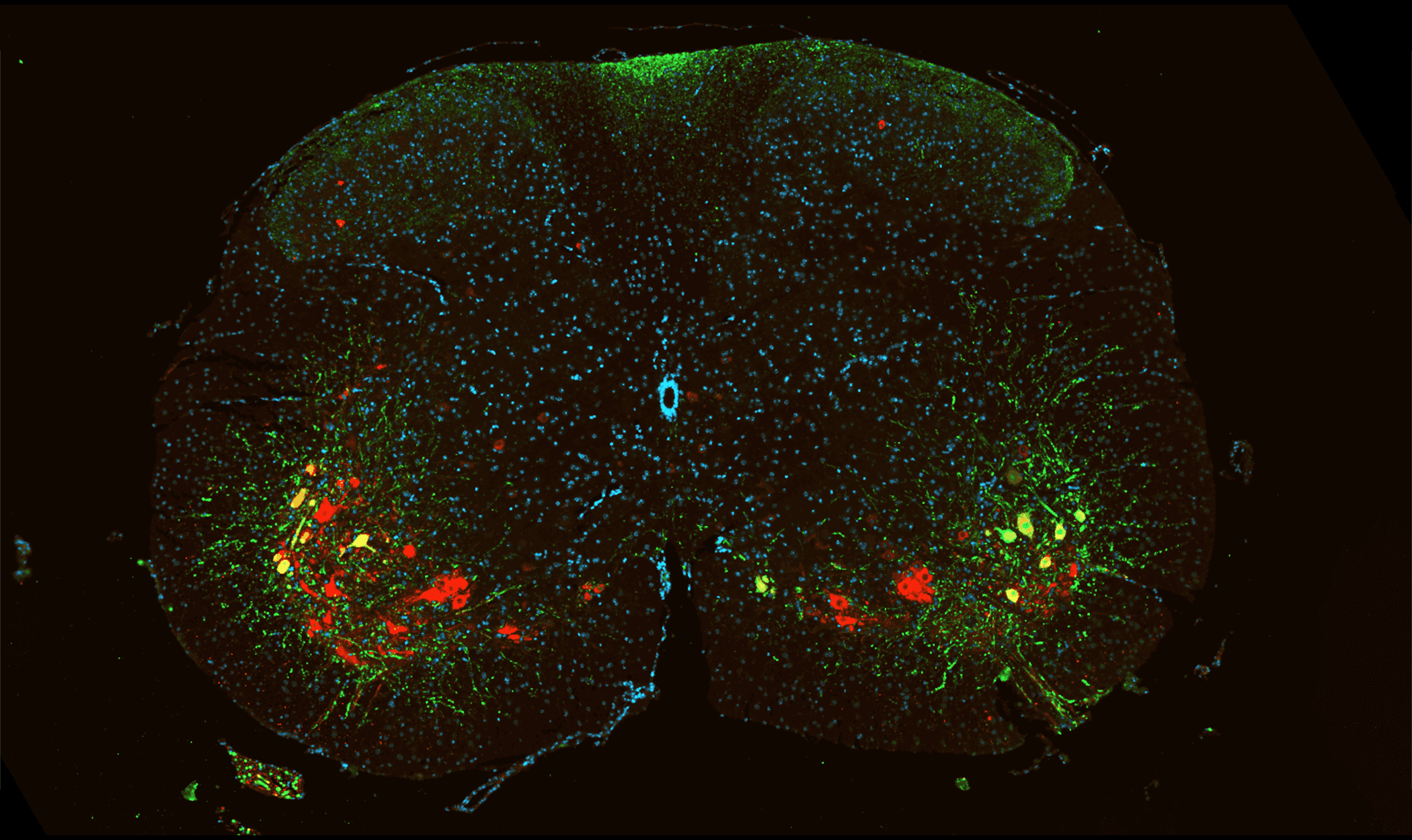 マウス脊髄における運動ニューロンの画像 