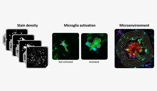 A composite of three different microscopic images or scans, each illustrating a different aspect of biological tissue analysis, potentially within the context of neurobiology