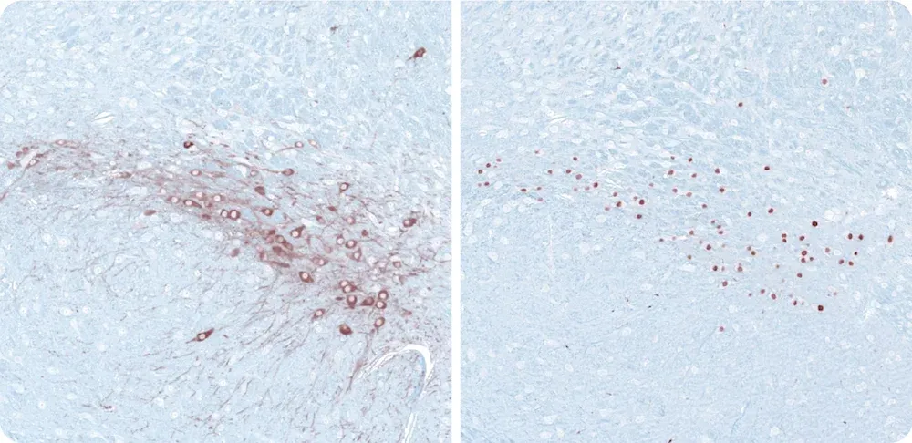 Coloration par immunohistochimie (IHC) de la substantia nigra de la souris