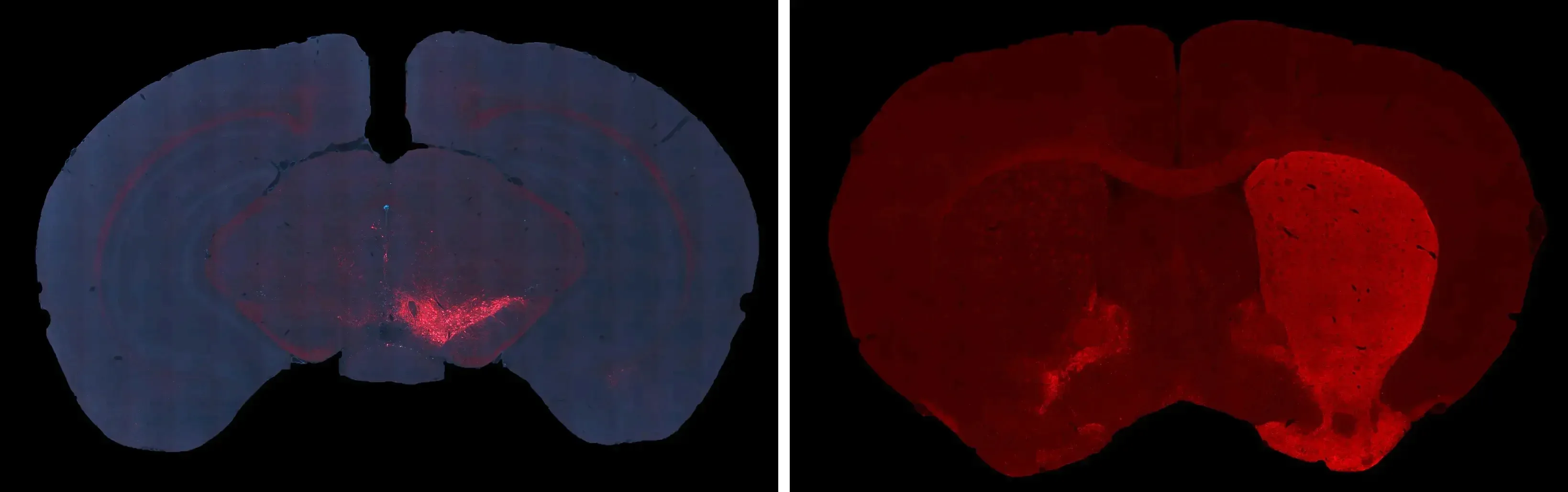 Tau Page_AAV-Tau 2N4R - Dopaminergic neuron loss.webp