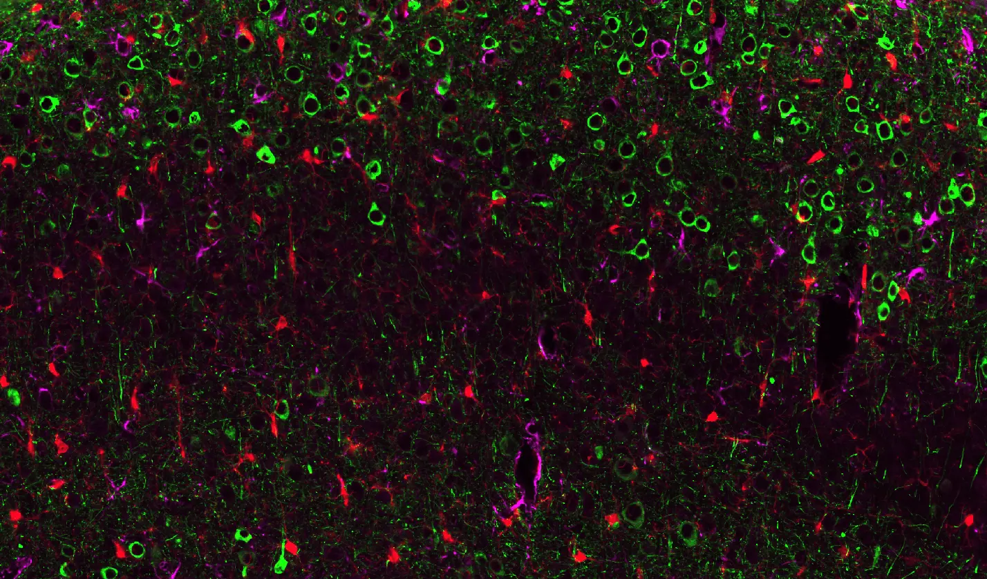 野生型マウスへのAAV-TauおよびTau-PFFsの投与による病理学的タウの種形成と拡散のイメージング  