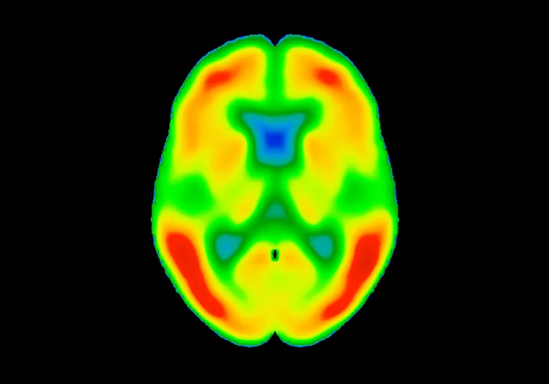 Tau and SUVR in brain