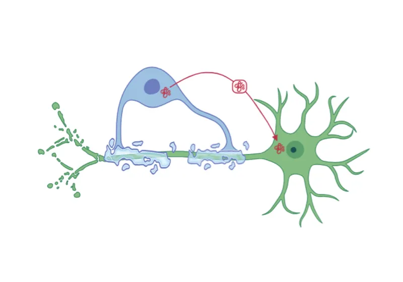 Illustration showing cellular dysfunction in Multiple System Atrophy