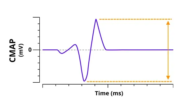 Electrophysiology - CMAP graph