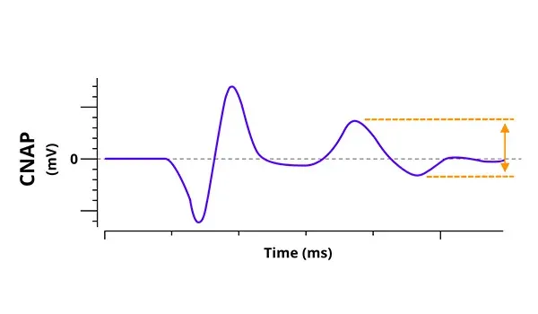 Electrophysiology - CNAP Graph