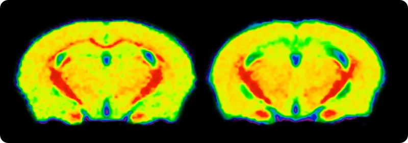 Two brain MRIs of a cuprizone mouse model, used to study MS-related demyelination, highlighting areas of variable signal intensity that may represent tissue changes due to demyelination.