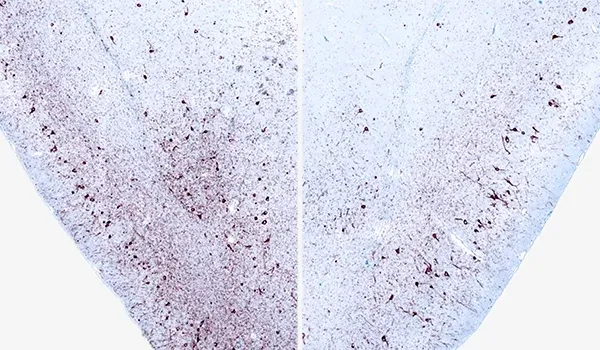 Deux coupes de tissu cérébral traitées par immunohistochimie (IHC) pour mettre en évidence l'alpha-synucléine phosphorylée, qui est importante dans le contexte de la recherche sur la maladie de Parkinson.