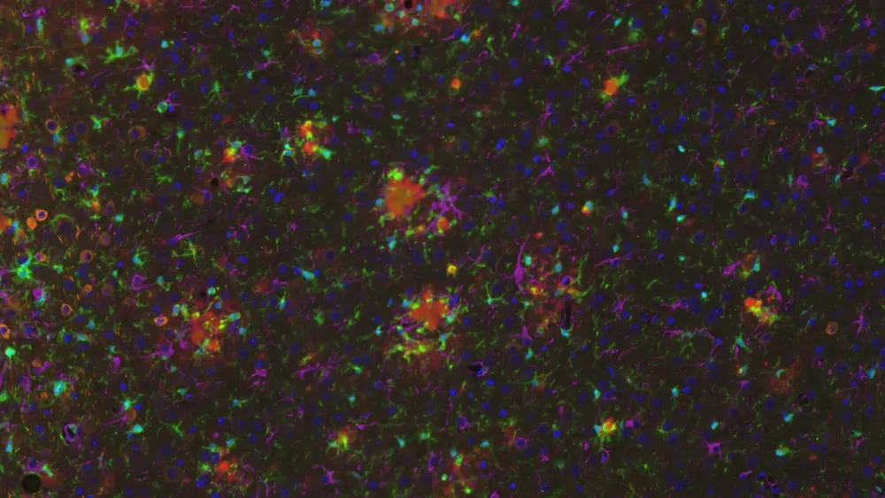 ARTE10-AAV-Tau - プラーク、ミクログリア、アストロサイト、およびタングル