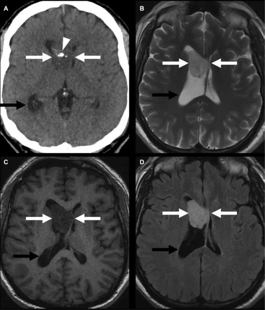 関節のMRI 関節のMRI 第2版 | 福田国彦, 上谷雅孝, 杉本英治, 江原 茂 |本