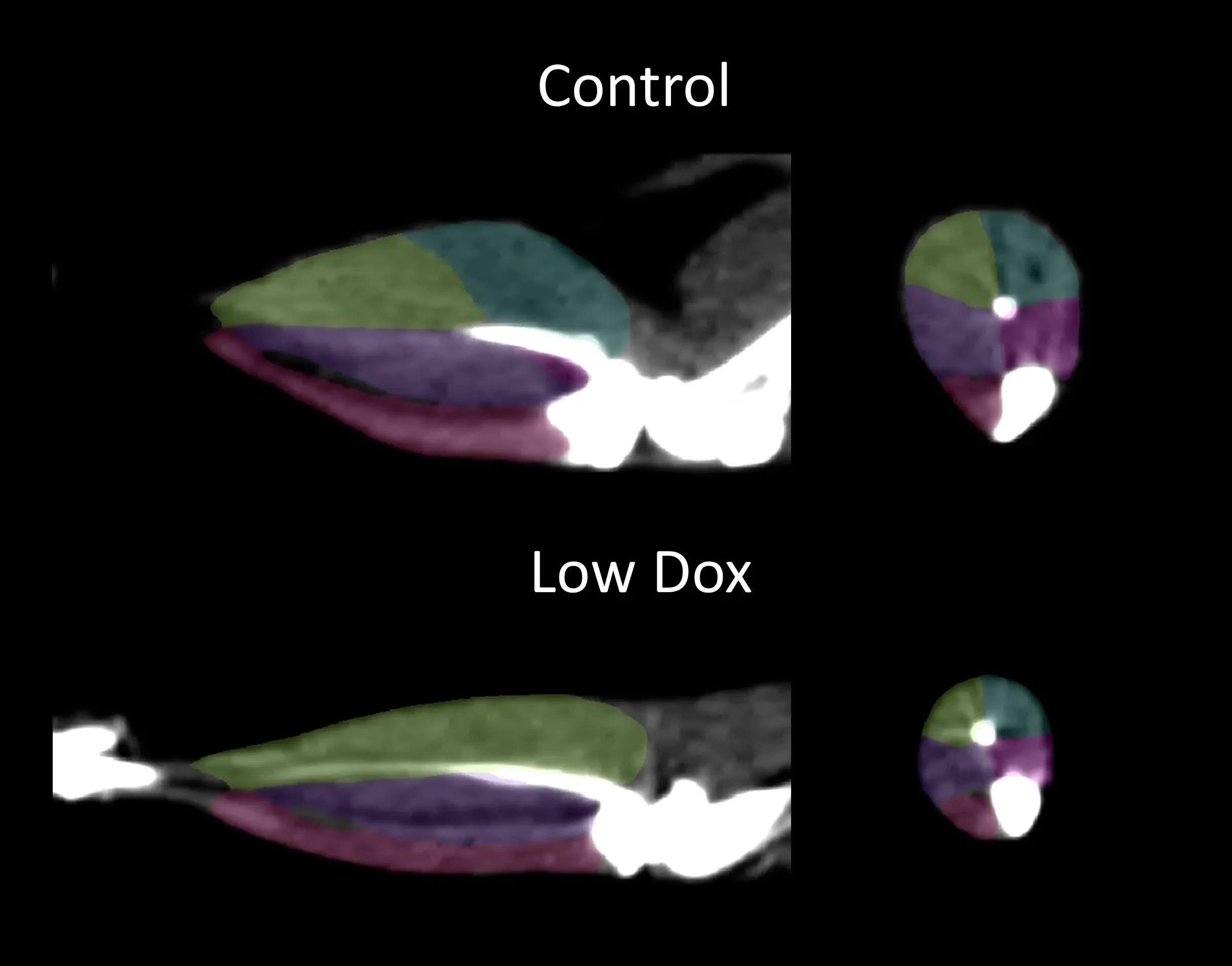 CT image with segmentation of the hindlimb muscles from Control (On Dox) and Low Dox mice