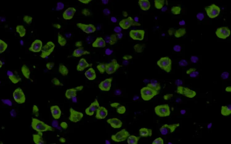 Animation of TDP43 in cytoplasm
