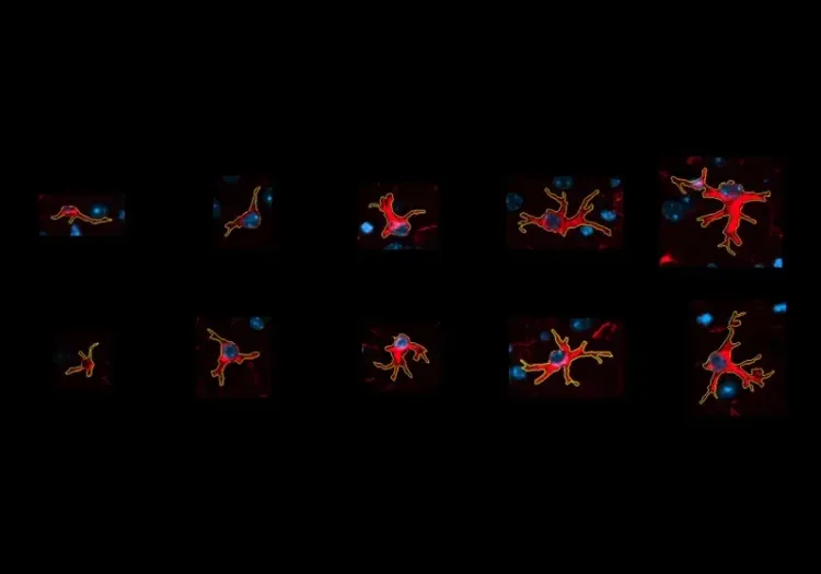 Progression of astrocyte hypertrophy