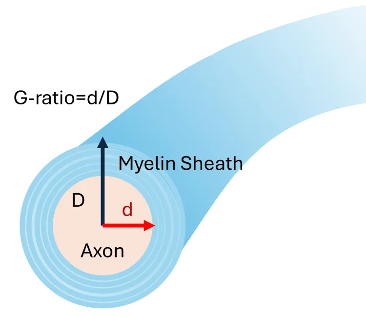 キュプリゾンモデルにおける脱髄と再脱髄