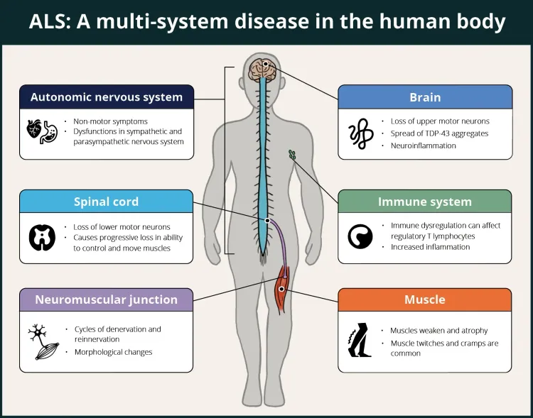 medium_Human_ALS_2_1_02288f979