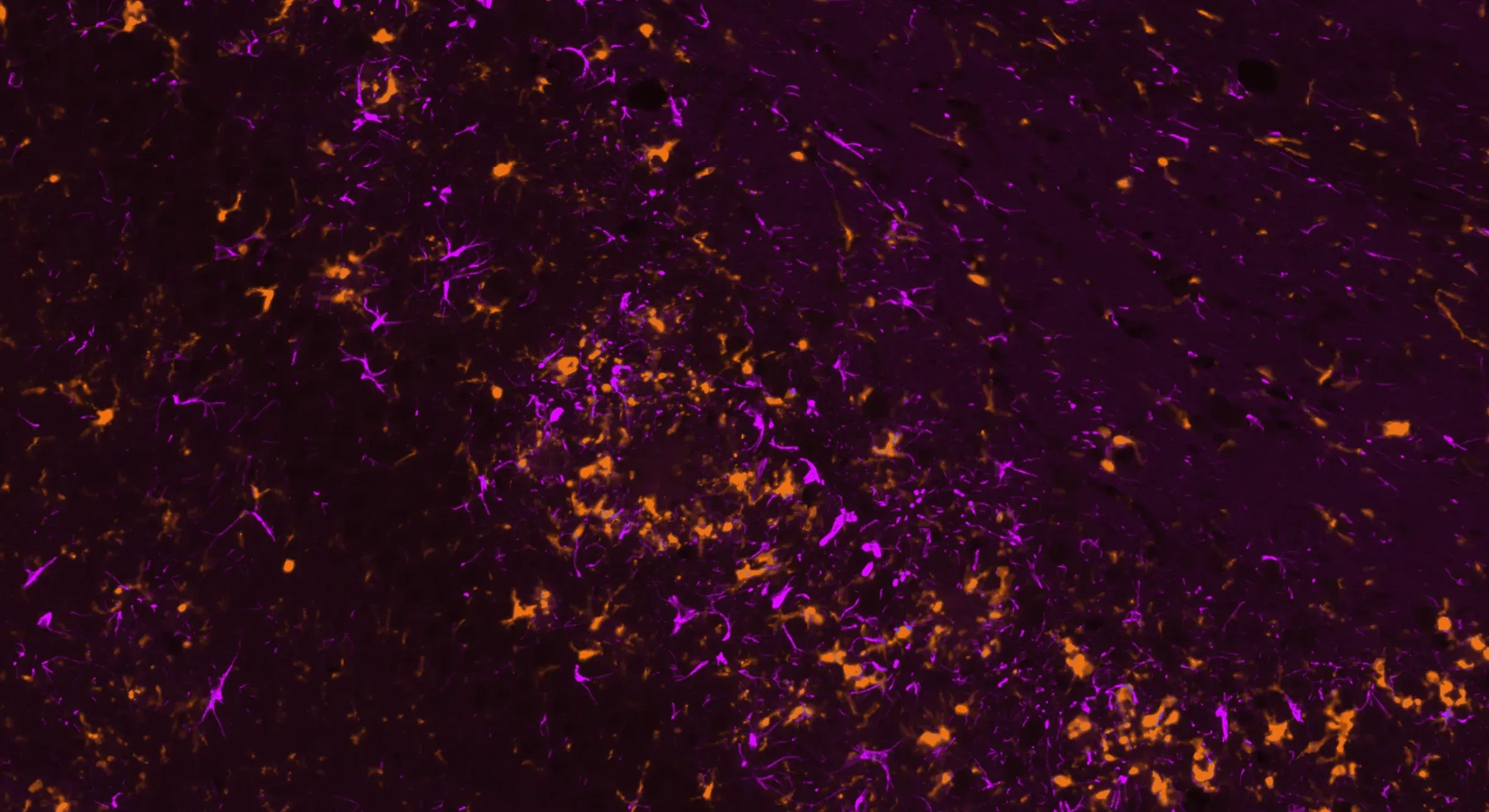 Iba-1 and GFAP double immunofluorescence staining in the injected SNc