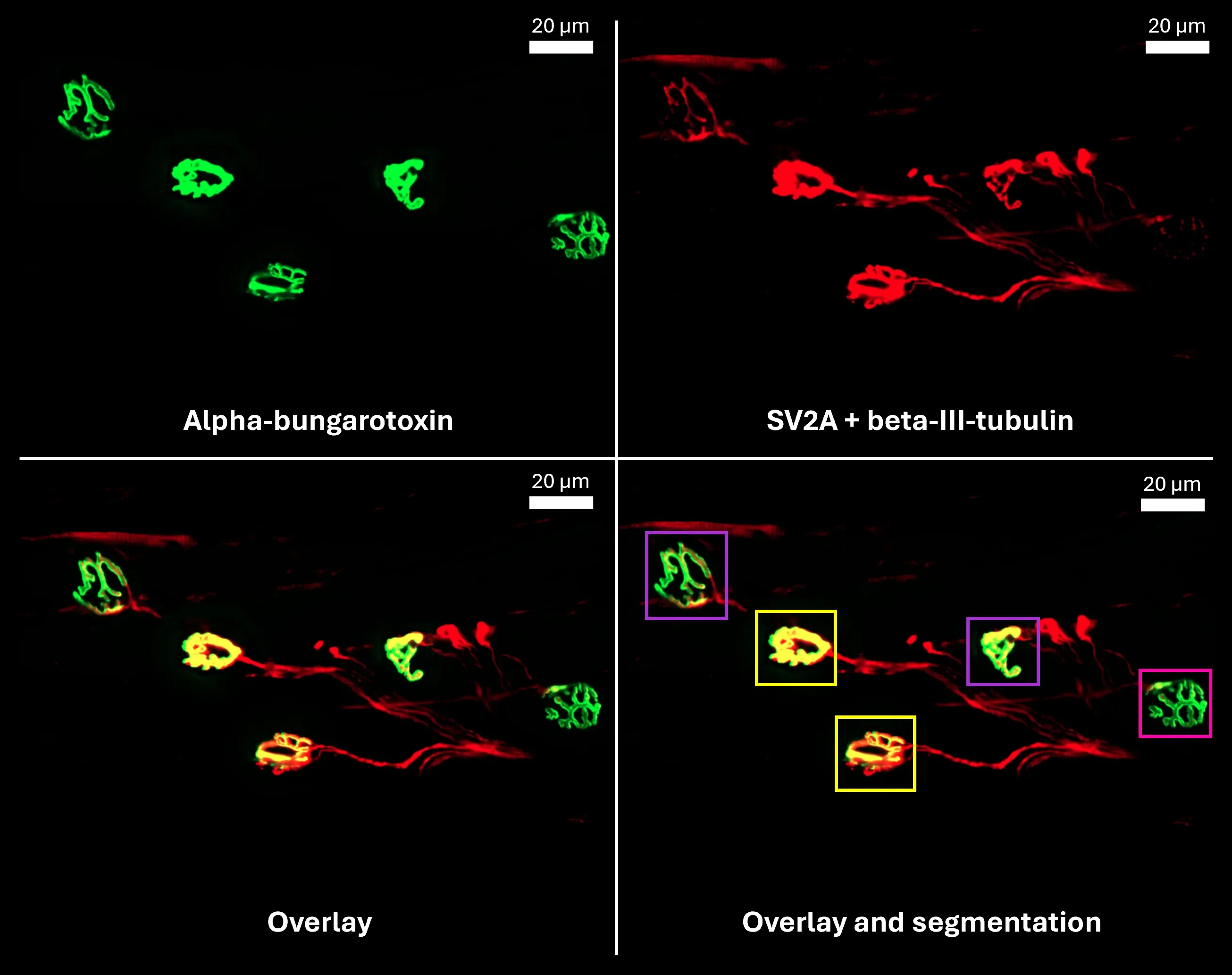 モンタージュ配置による神経筋接合部の筋肉画像