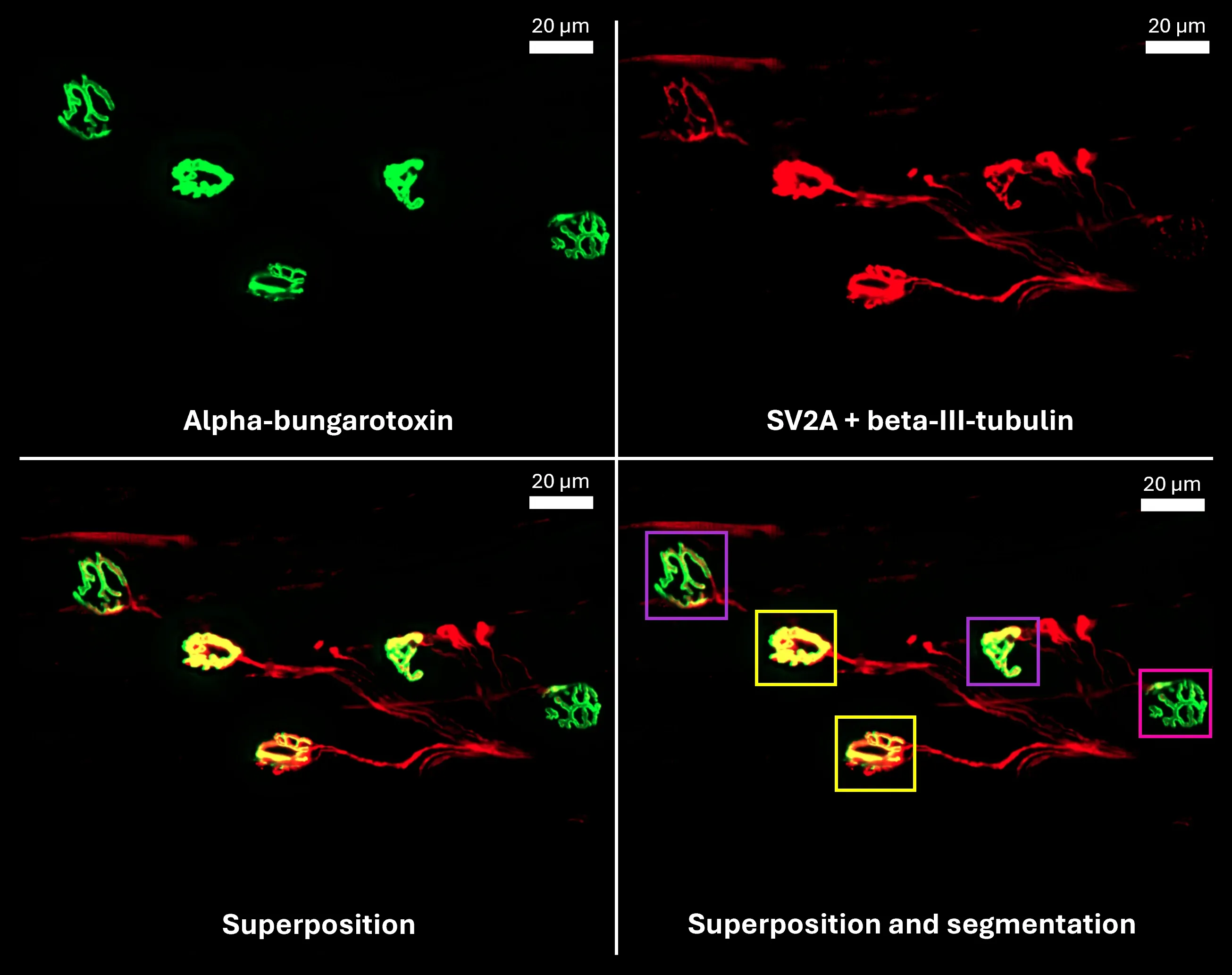 Images des muscles NMJ dans une disposition de montage