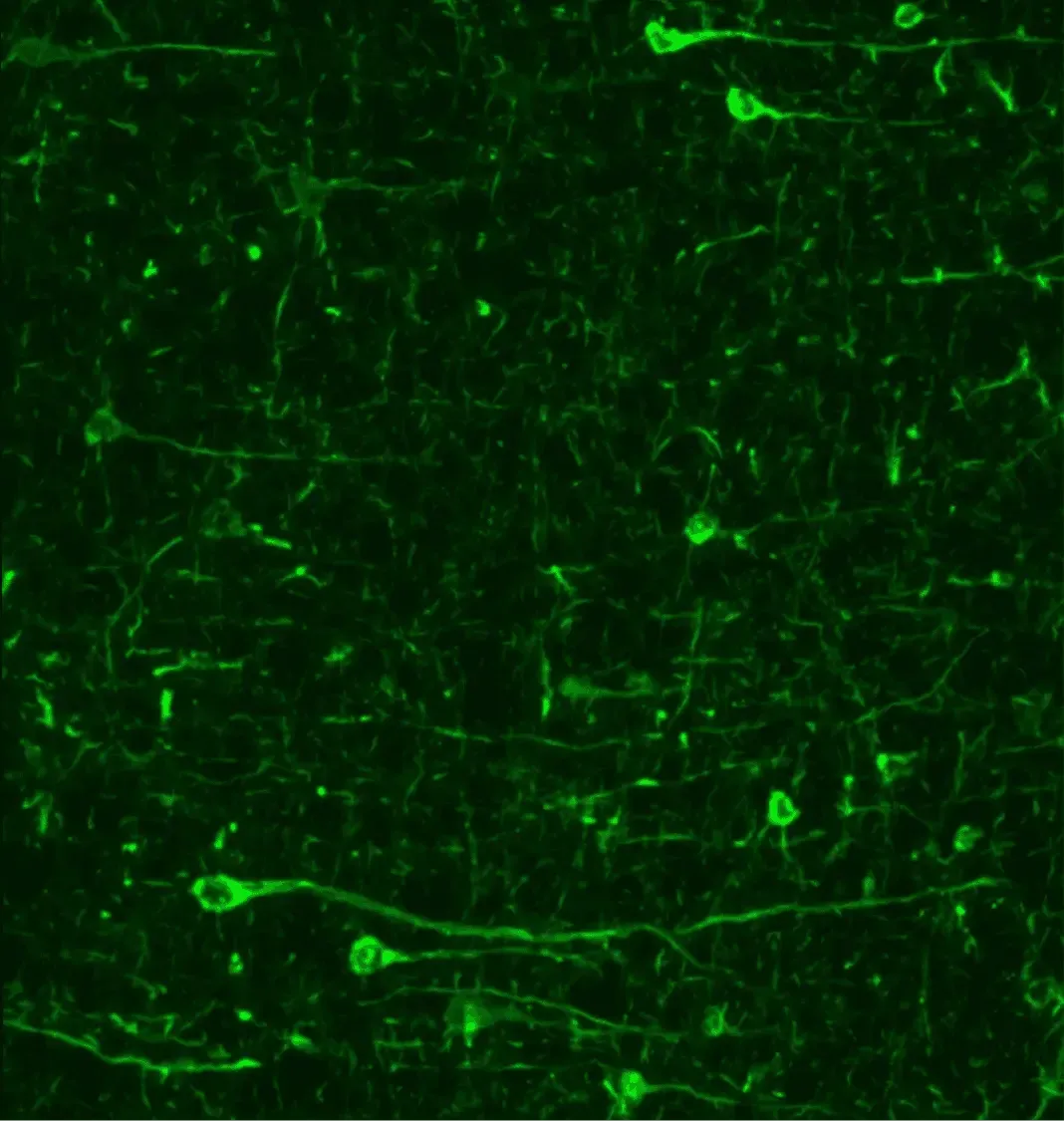 IF image of synuclein in low magnitude