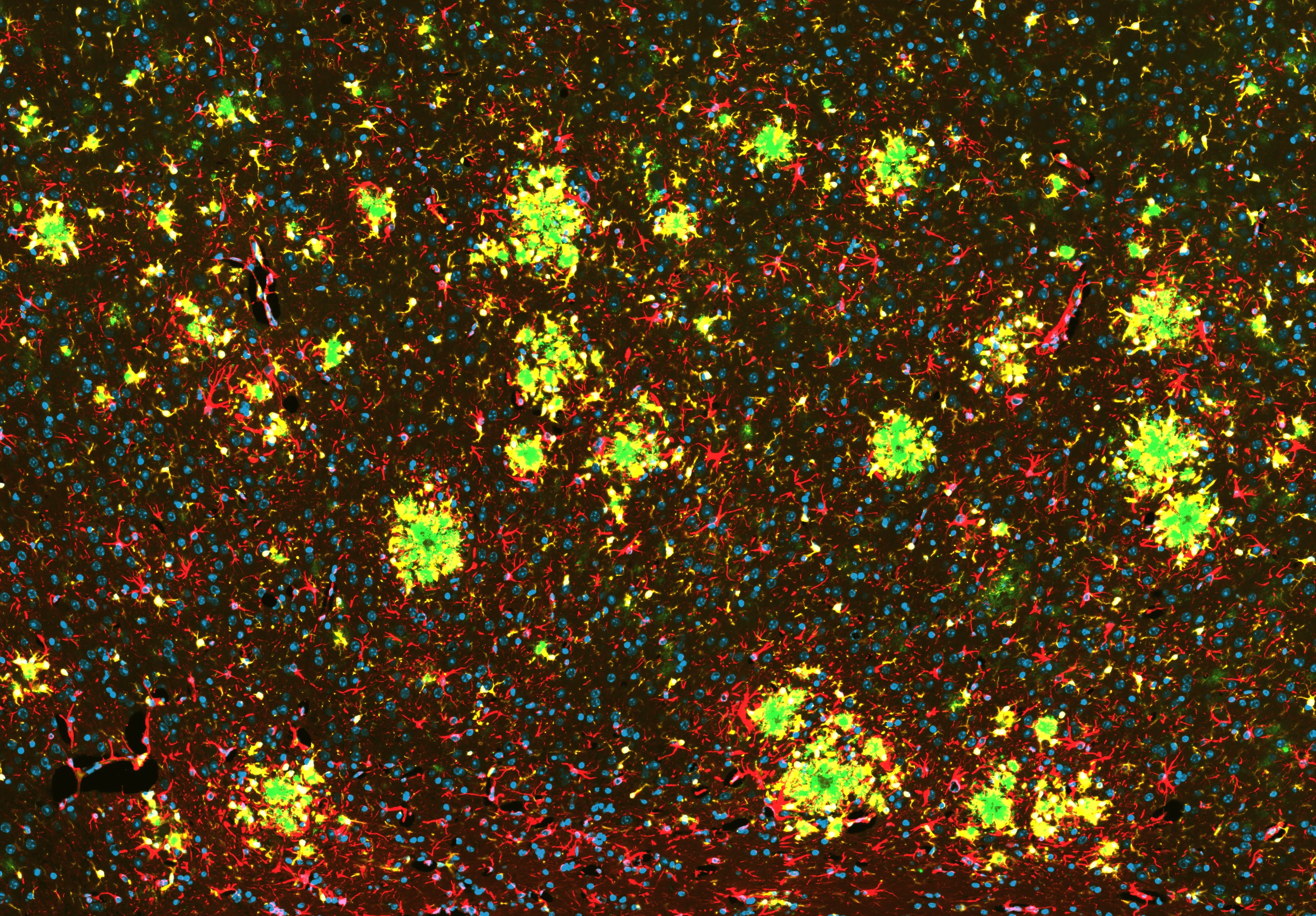 APP/PS1マウスの脳におけるアミロイドβ病理とグリア細胞活性化を示す画像 