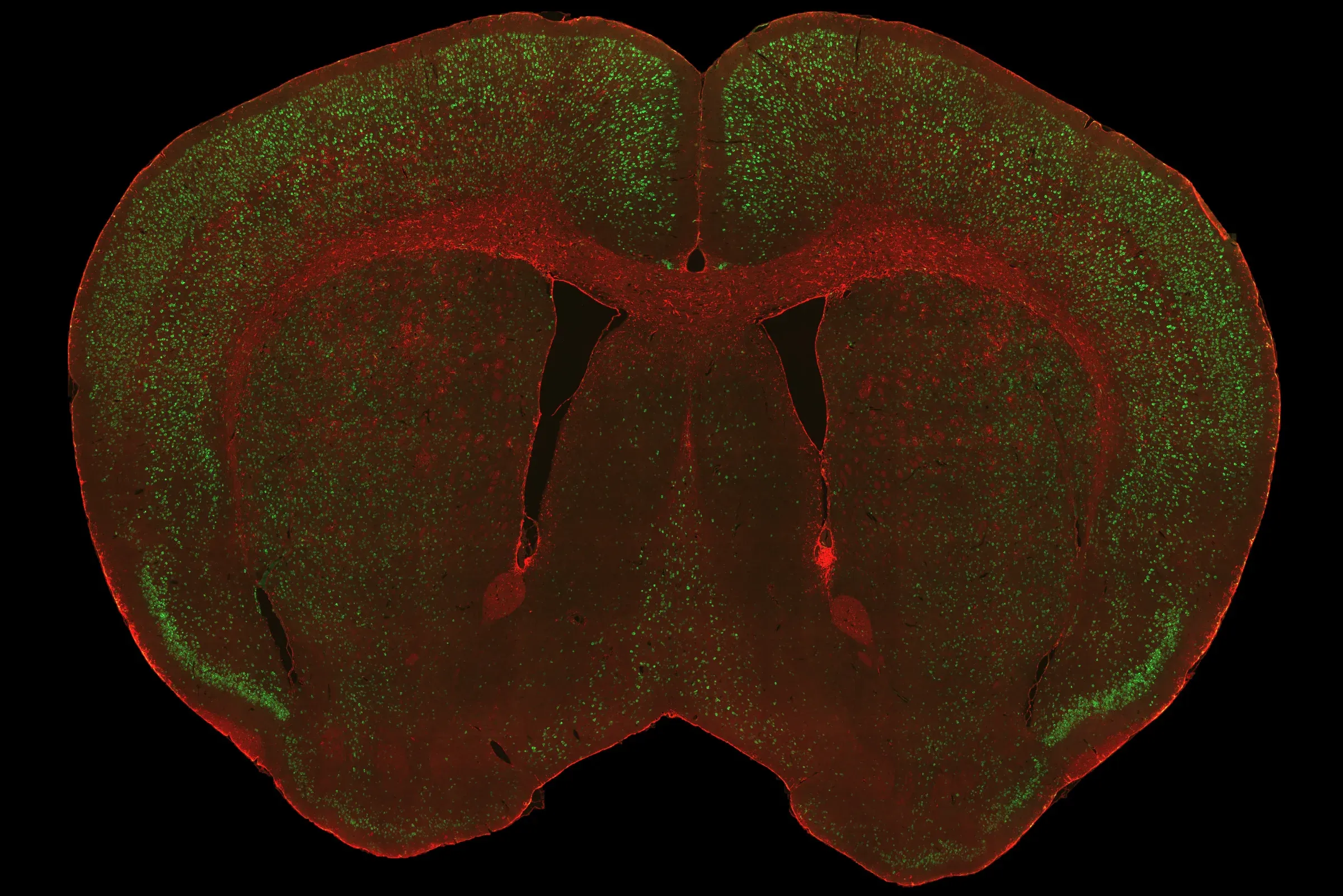 rNLS8 coronal brain TDP-43 + astrocytes