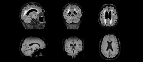 small_Clinical_Eligibility_MRI
