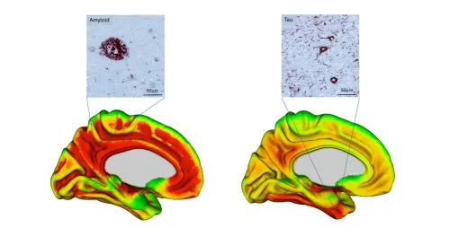 small_Resource_Longitudinal_Ch