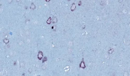small_TDP_43_Transgenic_Models