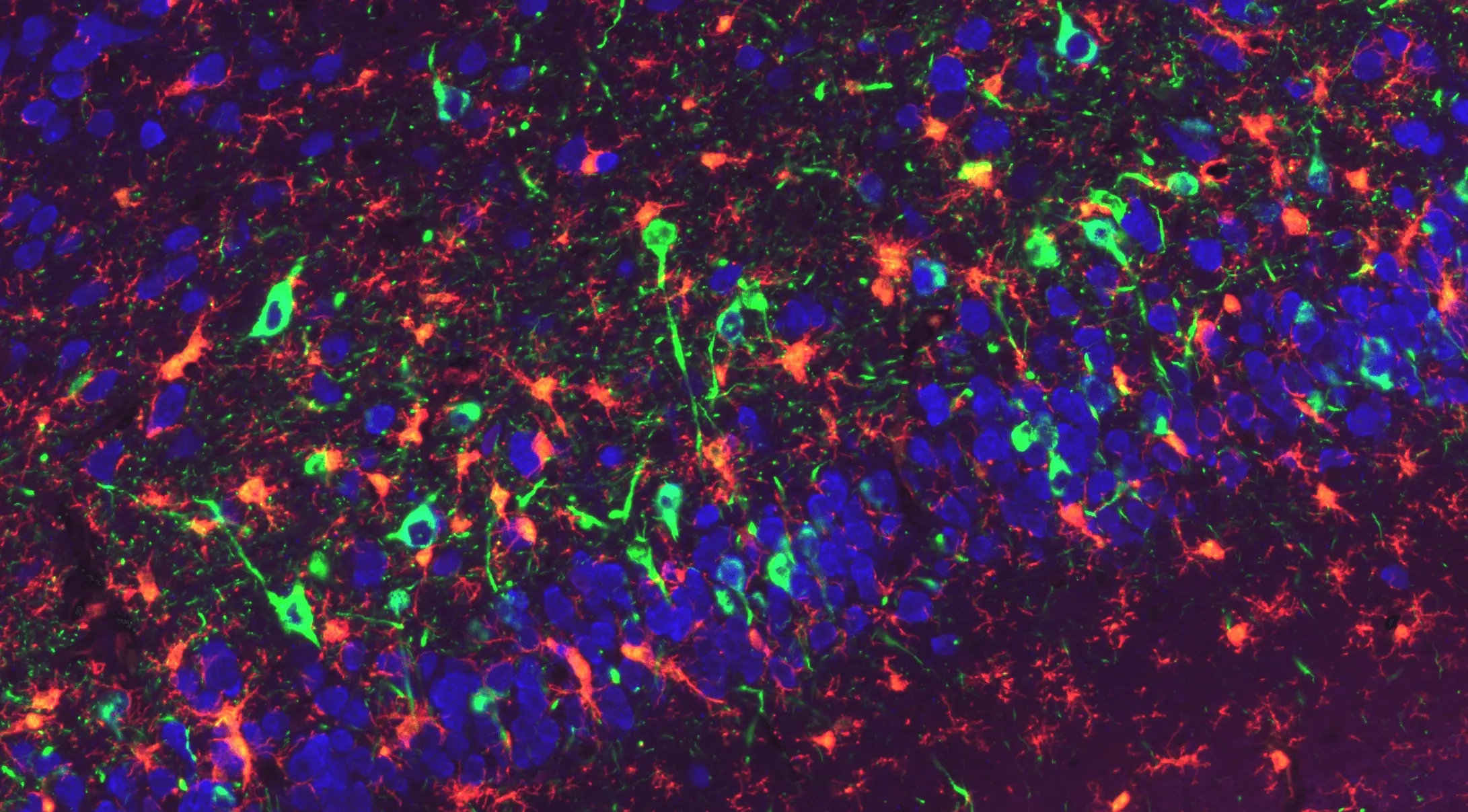 M83遺伝子欠損マウス（M83+/-）の梨状皮質におけるリン酸化α-シヌクレイン病理像とミクログリアの関与 