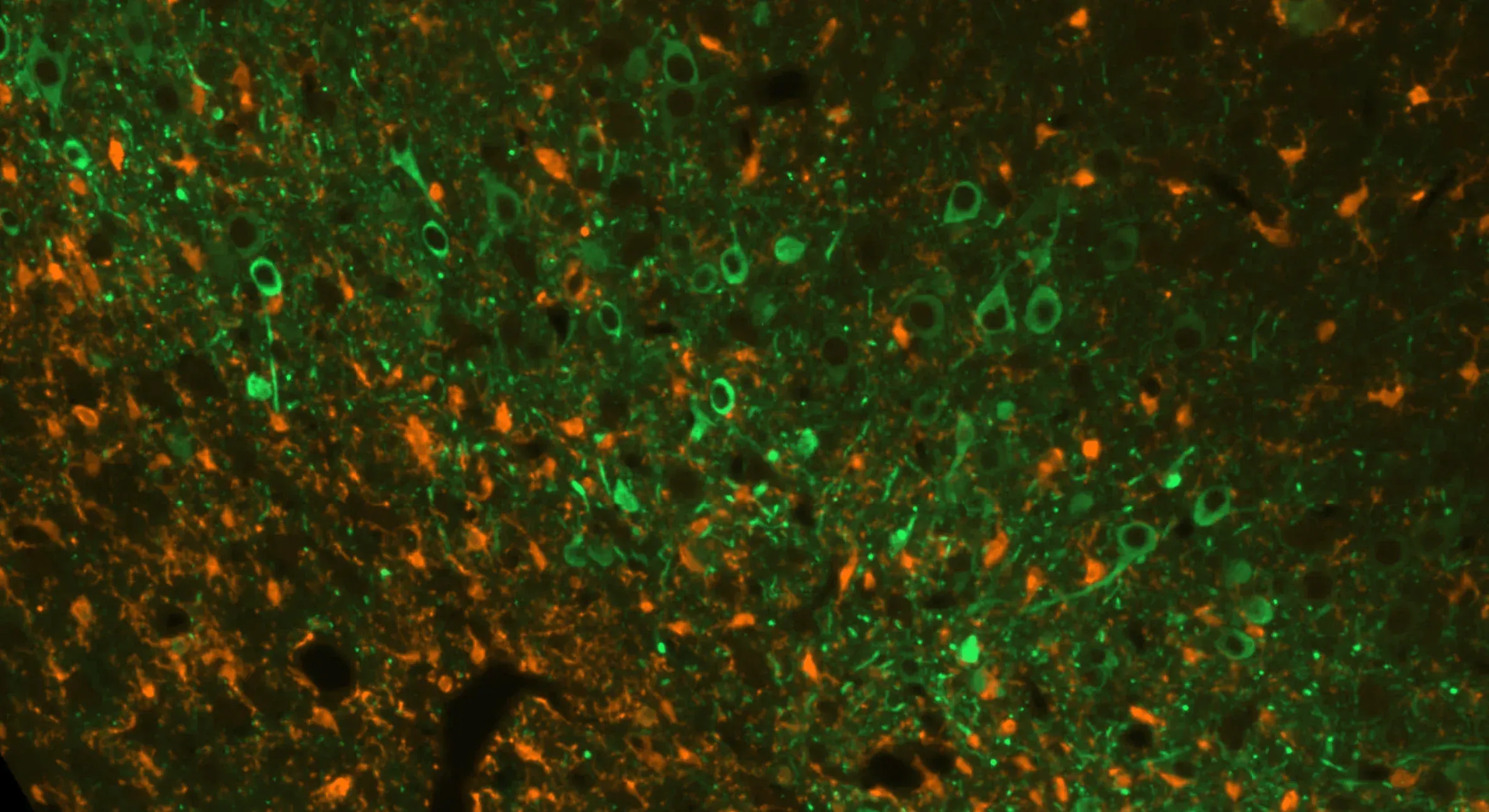 Microglia & Tau multiplex immunofluorescence image