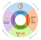 thumbnail_Microglial_senescenc