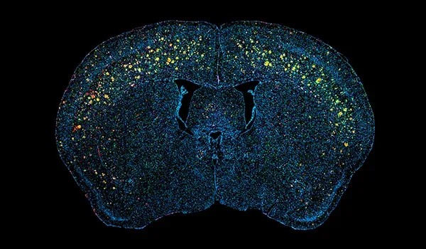 Beta-amyloid Model mIF Scan